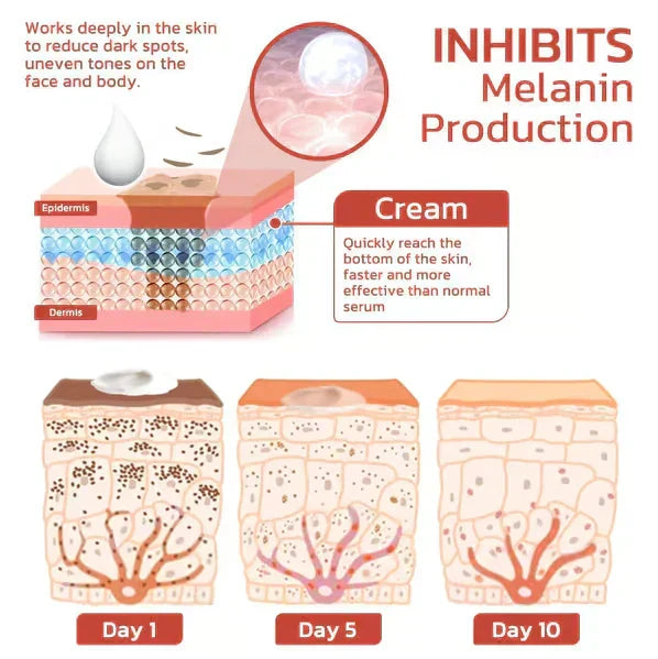 ⚡Anti-Freckle Cream Sale! ⏳🎉